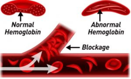 MEDICINSK BOMB: Blodläkaren släpper fynd som visar att Modernas mRNA-covidvac...